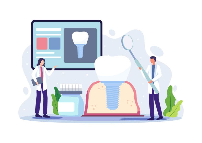 How dental implants differ