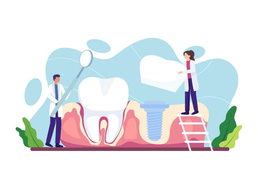 The benefits of implant treatment